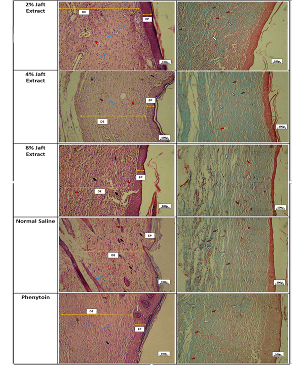 Representative micrographs of wound healing on day 15; HE staining (first column) and trichrome staining (second column) in phenytoin, normal saline, 2%, 4%, and 8% Jaft extract groups under × 100 magnifications.