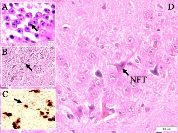 Histological appearances of A, iron accumulated hippocampal neurons (LM, hematoxylin eosin (H&amp;E), × 10); B, degenerated neurons in dead walley (LM, H&amp;E, × 10); C, iron particles in degenerated hippocampal regions (LM, H&amp;E, × 10); D, and neurofibrils included neuron (LM, H&amp;E, × 20) in a study rat