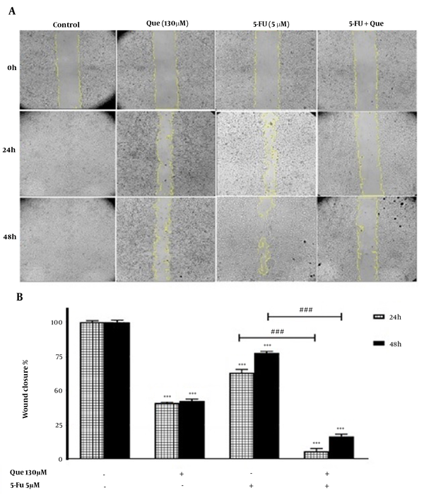 Wound healing assay of HUVECs treated with 5-FU and Que. A, Image of HUVECs migration following treatment with Que (130 μM), 5FU(5 μM), and their combination for 0, 24, and 48 h; B, Quantitative analysis of the anti-migration effect of Que (130 μM), 5-FU (5 μM), and their combination for 24 and 48 h. The results are shown as the mean ± S.E.M of three independent experiments (***P &lt; 0.001 compared with the control, ###P &lt; 0.001 compared with 5-FU-alone group).