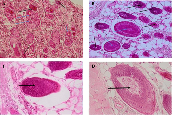 Hematoxylin-eosin staining in experimental groups 21 days after the last administration; Black and white arrows showing the telogenic and anagenic hair follicles, respectively; A, Grape sap-treated group (10 mg/kg); B, Grape sap-treated group (100 mg/kg); C, untreated group receiving bleomycin 21 days after the last administration (×20 magnification), arrow showing the telogenic hair follicle; D, Normal saline group 21 days after the last administration (×20 magnification), arrow showing the anagenic hair follicle (×10 magnification).