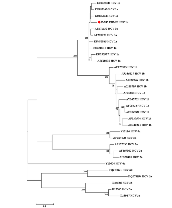 The phylogenetic tree conducted based on the sequences of a conserved region of the nonstructural protein 5B gene of the hepatitis C virus obtained from the peripheral blood mononuclear cell sample of 1 working child with occult hepatitis C virus infection, as well as those corresponding to various hepatitis C virus reference sequences retrieved from the GenBank database. The bootstrap values equal to or greater than 70 obtained after 1000 replicates are illustrated in the nodes of the tree.