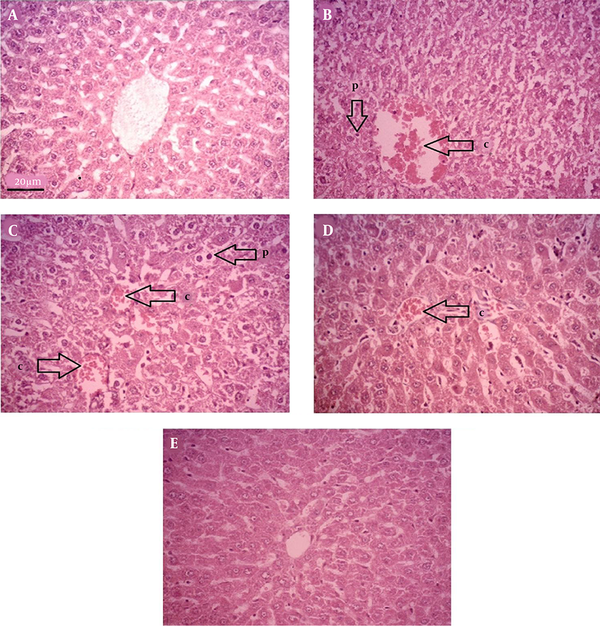 Histopathological observations showing the effects of zingerone on rat liver tissue. (sections stained with Hematoxylin &amp; Eosin, magnification X 200) [C, congestion of RBC; P, pyknosis; A, control; B, MTX; C, ZG25; D, ZG50; E, ZG100].