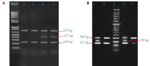 Tetra-primer amplification-refractory mutation system–polymerase chain reaction analysis of TNF-α (-308 G/A [A] and -863 C/A [B]) gene polymorphisms: Lane 1-A: 50-bp DNA ladder. Lanes 2 and 3: GG genotype. Lanes 4 and 5: GA genotype. Lane 3-B: 50-bp DNA ladder. Lanes 2 and 5: AA genotype. Lanes 1 and 4: CA genotype.