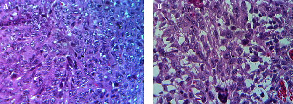 Hematoxylin and eosin staining from tumor mass revealing more tumor necrosis in the control group (A) compared to the test group (B).