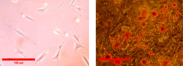Periodontal ligament stem cells and their characterization. A, In the third passage (20X); B, Adipogenic differentiation. The lipid vacuoles were stained using oil red (20X).