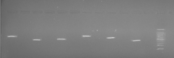 PCR product electrophoresis, group B exons on 1.5% agarose gel
