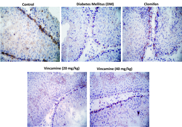 Immunolocalization of the claudin-11 in the testes of rats in each group. Immunostaining was seen positive with DAB brown along with blue counter stained with hematoxylin (original magnification X400).