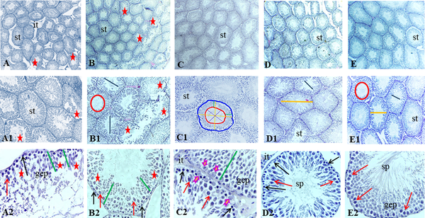 A, Histological images of testicular tissue following Mallory trichrome staining under light microscopy in different groups: (1) Control (A-A2), (2) gavage (B-B2), (3) exercise (C - C2), (4) rosemary extract (D-D2), (5) exercise and extract (E-E2) groups (× 40, × 100, and × 400 magnification). Seminiferous tubule (st), germinal epithelium (gep), interstitial tissue (it), spermatozoa cells (sp). Detachment and destruction of germinal epithelium (red star), Spermatogonia cells (black arrow), primary spermatocyte (red arrow). Sertoli cell (arrowhead). Tubal and luminal circumferences are demonstrated by blue and red circles, respectively. The yellow line points to seminiferous tubule diameter, the purple line shows the luminal diameter, and the epithelial height is marked by the green line.