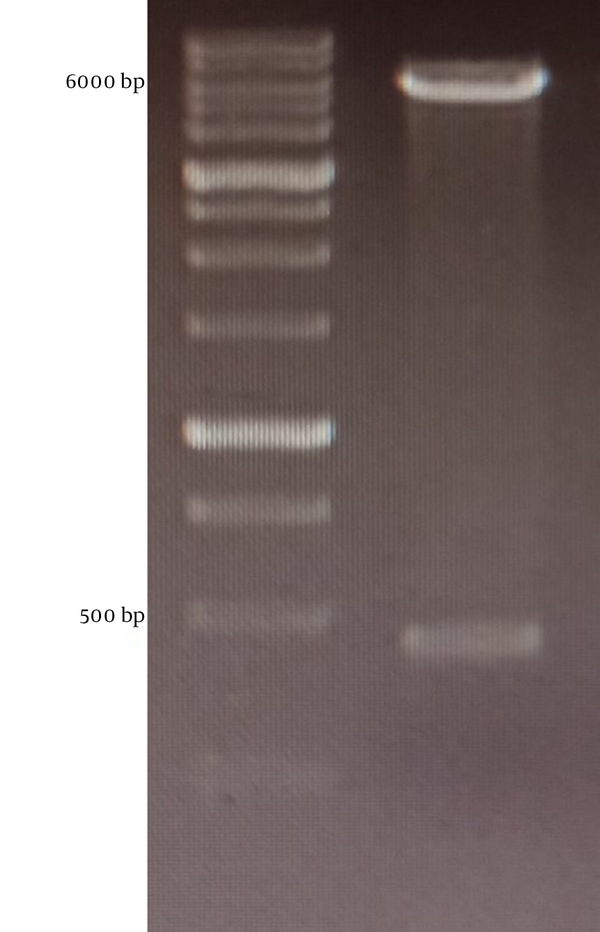 Confirmation digestion. pET26b plasmid containing mPD-1 extracellular domain gene digested with NdeI and XhoI gene.