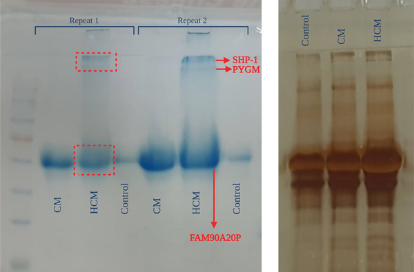 Staining of SDS-polyacrylamide gel electrophoresis with 2 dyes: Coomassie blue and silver nitrate.