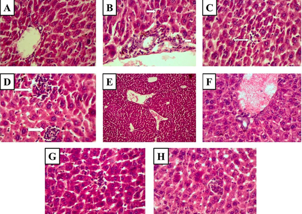 Histopathological observations (the stained liver sections using H&E; magnification X 400) reveal CD effects on cisplatin-induced hepatotoxicity changes in the liver. (A) Control (non-cisplatin treated). (B) Mild portal and periportal inflammation in some portal areas in the cisplatin group. (C) Focal lytic necrosis in the cisplatin group. (D) Confluent necrosis in the cisplatin group. (E) Portal inflammation in the cisplatin + 50 mg/kg CD group. (F) Portal inflammation in cisplatin + 100 mg/kg CD group. (G) Focal lytic necrosis in cisplatin + 50 mg/kg CD group. (H) Focal lytic necrosis in cisplatin + 100 mg/kg CD group.