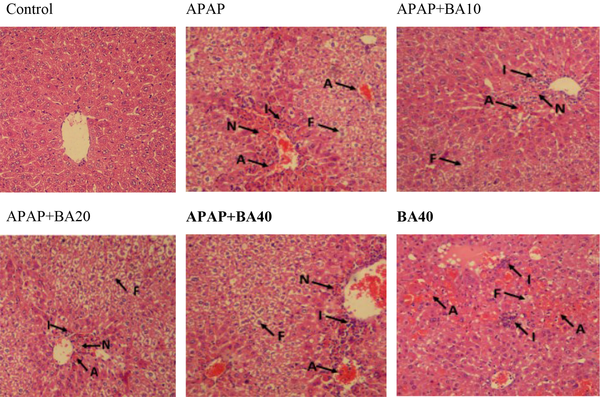 Effect of biochanin A (BA) on the histopathological lesions of acetaminophen (APAP)-induced liver injury. The beneficial effects of BA are shown in the figure. Arrows: A, accumulation of blood cells (RBCs); I, Inflammation; N, Necrosis; F, Fat deposit; Magnification: ×100