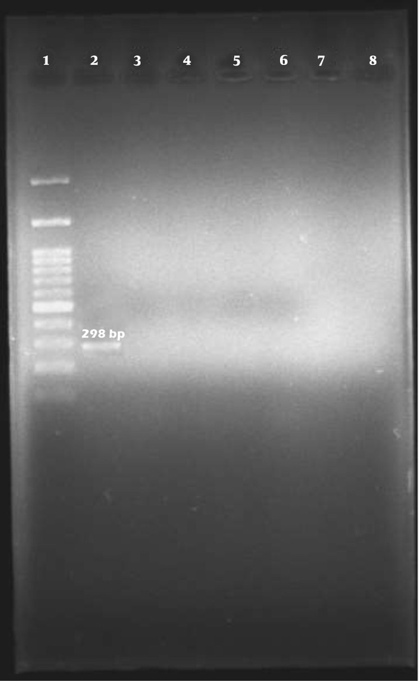Lane 1 is a marker (100 bp). Lane 2 is positive control (E. coli O113:NM) that bands within 298 bp. Lane 3 is negative control (double distilled water). Lanes 4 - 8 are negative samples.