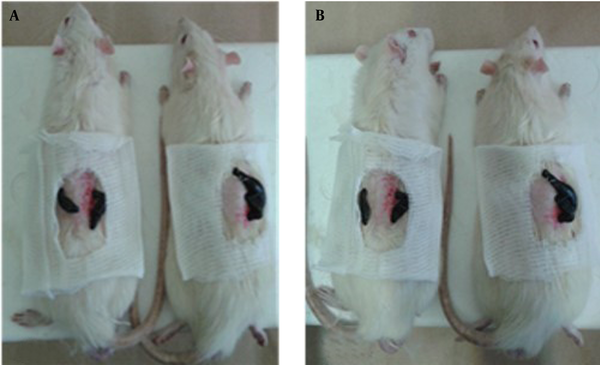 (A) Healthy male leech-treated rats and (B) Alloxan-induced diabetic male rats treated with leeches.