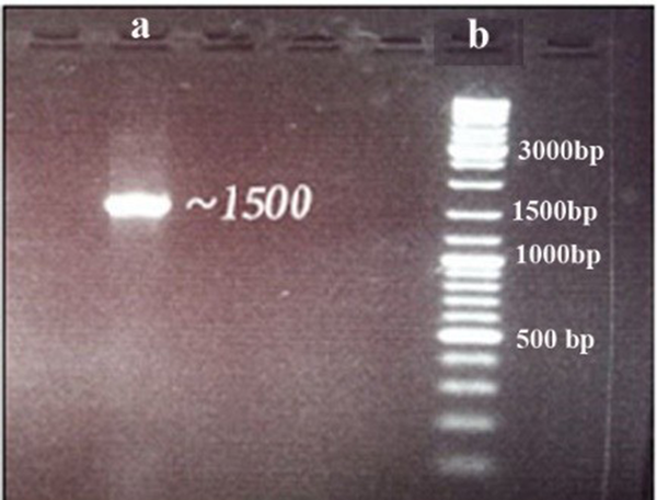 16S rRNA amplification and sequencing, (A) PCR amplification product, (B) DNA ladder (GeneRuler SM 033)