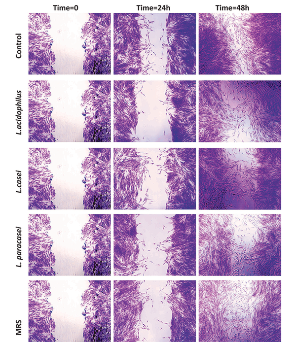Qualitative investigation of the effect of lyophilized cell-free supernatants of three probiotic bacteria on the migration of proliferation of periodontal ligament stem cells at 0, 24, and 48 hours after treatment Qualitative investigation of the effect of lyophilized cell-free supernatants of three probiotic bacteria on the migration of proliferation of periodontal ligament stem cells at 0, 24, and 48 hours after treatment