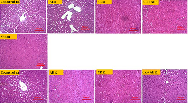 Images of different histological grades of fatty liver degeneration. CR, caloric restriction; AE, aerobic exercise.
