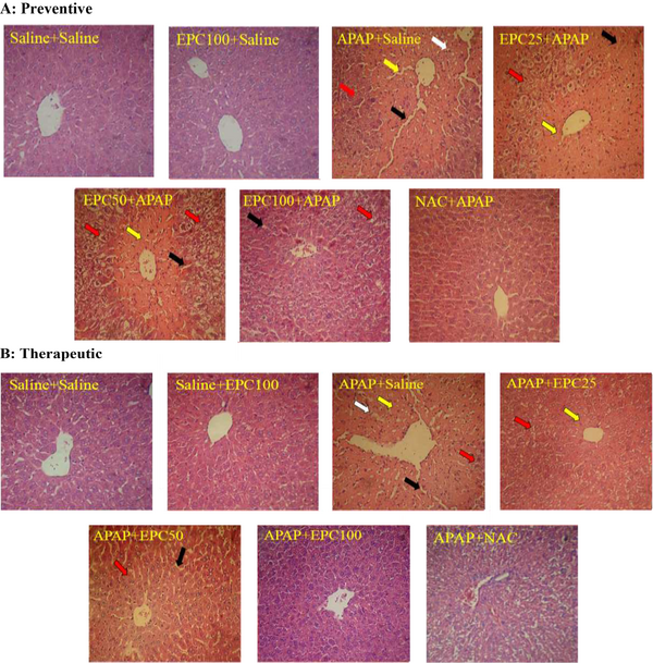 Preventive and therapeutic effects of epicatechin (EPC) and N-acetylcysteine (NAC) on APAP (acetaminophen)-induced hepatic histopathological injury in mice (n = 6 in each group). Preventive (A) and therapeutic (B) effects. Coagulative necrosis in hepatocytes (yellow arrow), fatty change in hepatocytes (red arrow), inflammatory cells (white arrow), and dilated sinusoids (black arrow). Saline, EPC 100 mg/kg (EPC100), APAP 400 mg/kg (APAP), EPC 25 mg/kg+ APAP 400 mg/kg (EPC25+ APAP), EPC 50 mg/kg + APAP 400 mg/kg (EPC50+APAP), EPC 100 mg/kg + APAP 400 mg/kg (EPC100+ APAP), NAC 50 mg/kg + APAP 400 mg/kg (NAC+APAP).