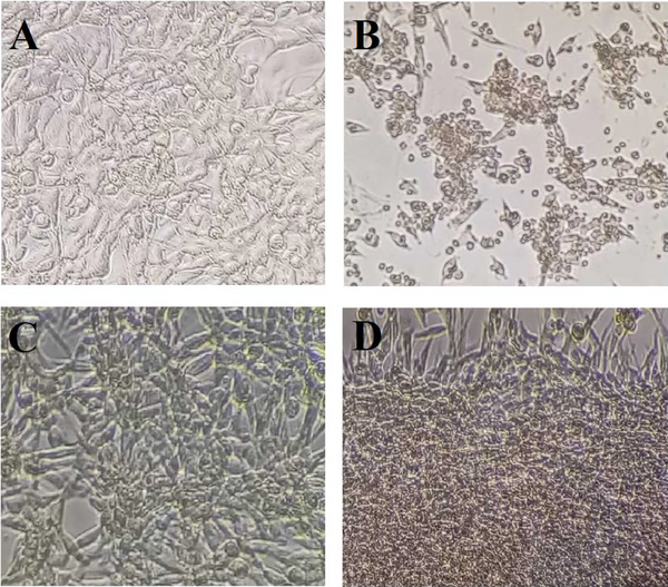 The microscopic images of PC12 cells were treated with different concentrations of DPP, Flv, and H2O2. (A) Vehicle control. (B) As shown, treatment with 100 µM H2O2 resulted in cell shrinkage after 4 h of exposure. (C) DPP exposure (500 µg/mL) suppressed morphological alteration induced by H2O2 on PC12 cells. (D) PC12 cells treated with 10 µM Flv inhibited cell death induced by H2O2. Scale bar, 100 µm.