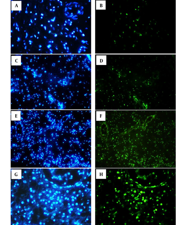 The left column shows bright blue nuclei stained with DAPI, and the right column shows bright green nuclei stained with TUNEL, which are considered apoptotic cells in the nasal polyp tissue. A and B show the control group. C and D (50 μg/mL SE); E and F (315 μg/mL SE); G and H (1000 μg/mL SE). SE: Sambucus Ebulus.