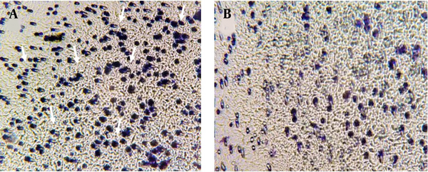 Transwell assay after 72 hours of cell treatment with IC50 concentration of sodium butyrate (NaB) (× 200): A, the untreated cells; B, cells treated with 3.1 mM of NaB. In part of A, several cells that have lost their ability to migrate have been marked by an arrow.
