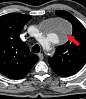 Int J Cardiovasc Pract