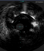 Multidiscip Cardio Annal