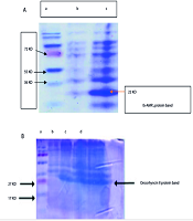 Jundishapur J Microbiol