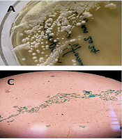 Jundishapur J Microbiol