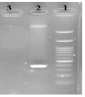 Comparison of Common Bacteria That Cause Meningitis in Cerebrospinal Fluid Samples by Culture and Polymerase Chain Reaction