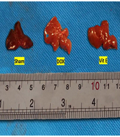 Combined the Vitamin E and Trimetazidine Therapy Ameliorate Hepatic Injury from Doxorubicin Administration in Mice