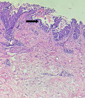 J Skin Stem Cell