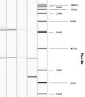 Jundishapur J Microbiol