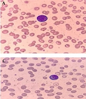 J Kermanshah Univ Med Sci