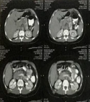 Int J Endocrinol Metab