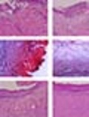 The Topical Effect of <i>Cappariss spinosa</i> Extract on Burn Wound Healing