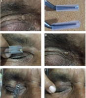 J Skin Stem Cell