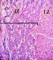 Zahedan Journal of Research in Medical Sciences