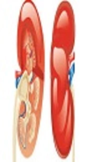 nephrotic syndrome, myVMC