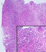 Archives of Clinical Infectious Diseases