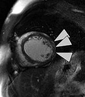 Multidisciplinary Cardiovascular Annals