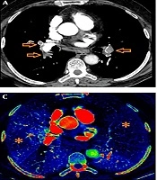 Iranian Journal of Radiology 