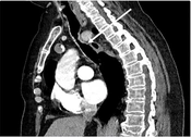 Multidiscip Cardio Annal