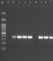 Jundishapur J Microbiol