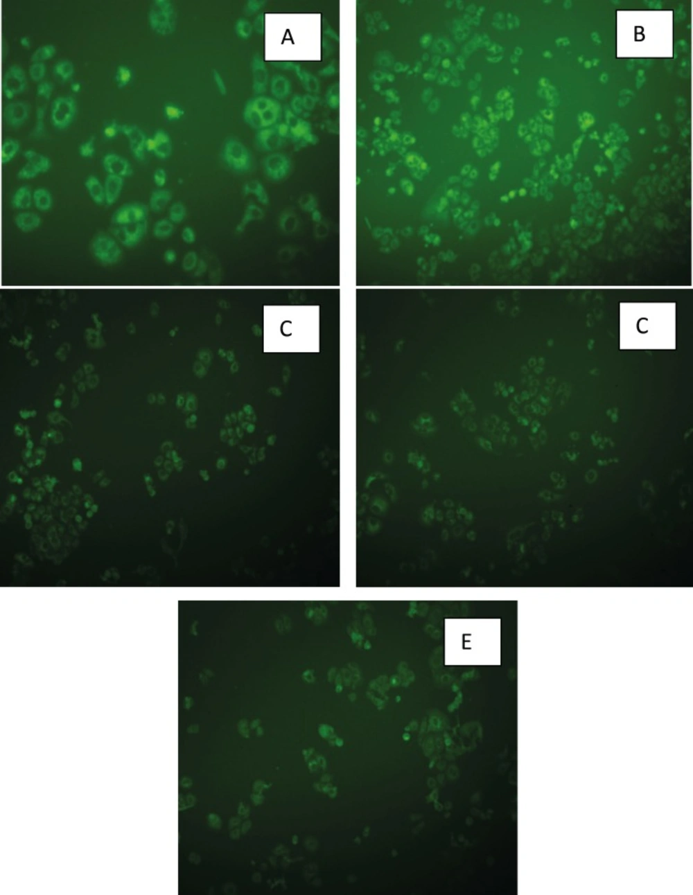 Fluorescent images of SKBR-3 cells incubated for 6 h with A) F2: Triacetin/Tween 20/<i>iso</i>-propanol (R<sub>sm</sub> of 1:2), B) F5: Triacetin/Tween 20/Transcutol (R<sub>sm</sub> of 1:2), C) F14: Triacetin/Tween 80/<i>iso</i>-propanol (R<sub>sm</sub> of 1:2), D) F17: Triacetin/Tween 80/ Transcutol (R<sub>sm</sub> of 1:2), E) methanolic solution of coumarin 6.