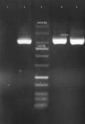 Emergence of NDM-1-Producing <i>Escherichia coli</i> in Iran