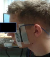 Middle East J Rehabil Health Stud