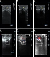 Iranian Journal of Radiology