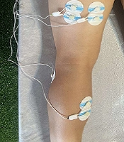 Middle East J Rehabil Health Stud