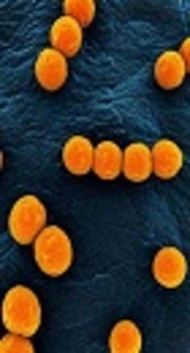 https://www.google.com/url?sa=i&source=imgres&cd=&cad=rja&uact=8&ved=2ahUKEwj7hv7S3OLeAhUG2aQKHUmmDFoQjB16BAgBEAQ&url=http%3A%2F%2Fhealthcare.bioquell.com%2Fen-uk%2Fresources-and-support%2Fmicrobiology%2Fenterococcus-faecium-faecalis&psig=AOvVaw2alkZ3lw0xRETo-Lc8QwrI&ust=1542794803083700